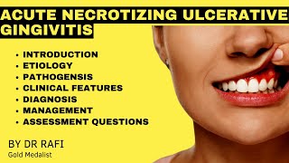 Acute Necrotizing Ulcerative Gingivitis Oral Medicine Lecture [upl. by Gabriele]