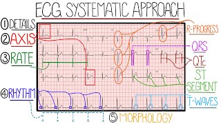 ECG Interpretation Made Easy Learn How to Interpret an ECG in 13 Minutes [upl. by Aenad]