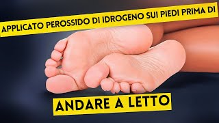 Ecco Cosa è Successo Dopo Solo 2 Volte Perossido di Idrogeno sui Piedi [upl. by Scully]