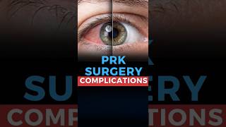 Photorefractive Keratectomy PRK Surgery Complications [upl. by Einra641]