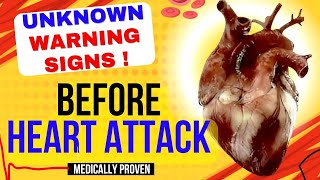 Warning Signs Before Heart Attack  how to heart attack Symptoms amp Signs You Should NEVER Ignore [upl. by Uamak]