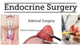 Endocrine Surgery 3  Euthyroid Goitre [upl. by Perice]