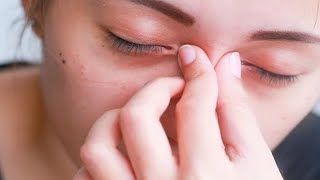 Home Remedies to Reduce Eye Swelling from Crying  Swollen eyes from crying  puffy eyes from crying [upl. by Aigneis921]