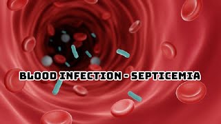 SEPSIS PATHOPHYSIOLOGY OF SEPTICEMIA [upl. by Anuahc]