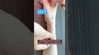 Needling Acupuncture Point Lung 7 acupuncturepoints [upl. by Enoob18]