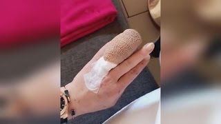 Lindsay Lohan Jokes After Losing Half of Her Finger in Boating Accident [upl. by Bauske]