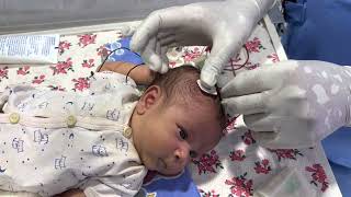 Part01  Cerebral Function Monitoring or amplitude EEG in newborn [upl. by Grunberg]