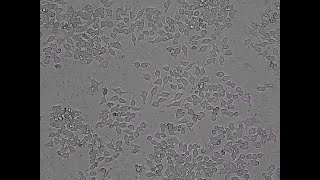 Fluorescence activation of pHrodo Deep Red E coli BioParticles during phagocytosis [upl. by Elsa436]