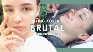 My First BRUTAL Korean Dermatology Experience 💉 BANOBAGI Laser Treatments  Sissel [upl. by Rucker]