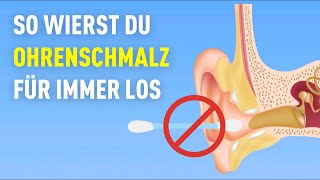 5 Ursachen für zu viel Ohrenschmalz und wie du ihn loswirst [upl. by Sueahccaz628]