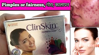 ClinSkin fairness soap uses in hindi कील मुहासे pimples darkness गोरा रंग [upl. by Bodi]