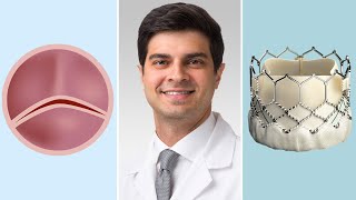 Bicuspid Aortic Valves Surgical amp Transcatheter Aortic Valve Replacement Options for Patients [upl. by Almeria]