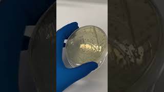 Microbiology test shortvideo viralvideo [upl. by Giffard356]