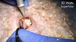 Quick and Bloodless Laser Tumor Excision [upl. by Grimbly]