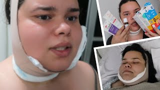 Fiz minha LIPO DE PAPADA 😱  Vlog Lipo de papada [upl. by Drucie]