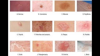 Skin Lesions with defination [upl. by Platus]