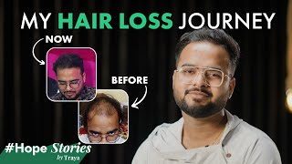 quotI Stopped My Genetic Hair Loss with This Productquot  Yasin Shares His Emotional Story HopeStories [upl. by Enelad]