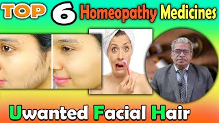 Unwanted Facial Hair Causes and homeopathy Treatment  Dr P S Tiwari [upl. by Ynnoj]