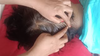 ASMR  Scalp Searching Sleep 😴😴🥱🥱✨ 170 [upl. by Karlee766]