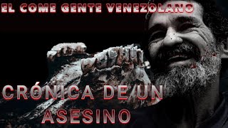 EL COME GENTE VENEZOLANO  Dorancel Vargas [upl. by Hgielsa510]