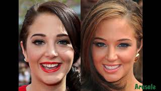 Celebrity teeth before and after [upl. by Navi986]