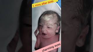 Cute newborn baby with charming eyes immediately after birth 😍 cutebaby [upl. by Derreg637]