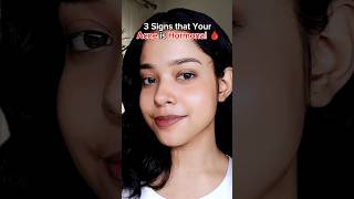 check Description 💓🎀 Hormonal Acne Solution Skincare Tips acne skincareroutine shortvideo [upl. by Gasperoni]