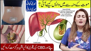 How To Remove Gallbladder Stone Without Surgery Gallbladder Stones Treatment Without Operation [upl. by Junia112]