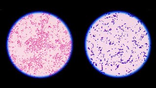 Staining technique in microbiology Gram staining [upl. by Reinke]