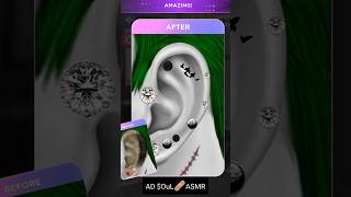 ASMR II EARWAX REMOVAL SATISFYING TREATMENT ANIMATIONDaDaASMR brainasmr2019 [upl. by Paquito]