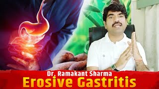 what is erosive gastritis  erosive gastritis symptoms। Dr Ramakant Sharma [upl. by Aihsad]