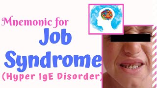 Job Syndrome Hyper IgE Syndrome Mnemonic [upl. by Yelir]