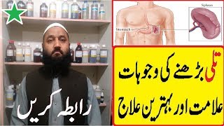 Spleen treatment tips in urdu [upl. by Llehsyar]