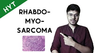 Rhabdomyosarcoma  HYT  NEETPG  INICET  FMGE pathology [upl. by Uyr]