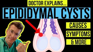 Doctor explains TESTICULAR LUMPS PART 1  EPIDIDYMAL CYSTS causes symptoms and treatments [upl. by Arahk]