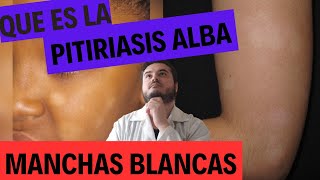 MANCHAS BLANCAS EN LA PIEL Que es la Pitiriasis Alba  Dr Juan [upl. by Silecara]