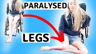 ♿️MY PARALYSED LEGS  limbdifferenceawarenessmonth [upl. by Atinahc548]