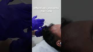 Why should you get Hair Exosomes therapy [upl. by Sennahoj]