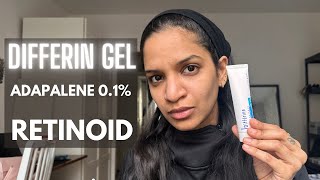 Differin gel  How to use Differin gel for Acne prone skin  Adapalene 01  Acne scars treatment [upl. by Hovey768]