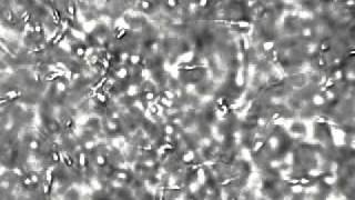 Semen sperm cells under the microscope at 400x [upl. by Ennaej]