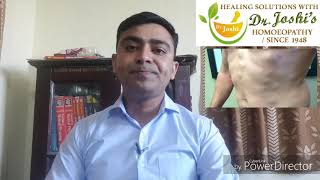 Lipoma Homeopathic Medicine For lipoma [upl. by Kahn]