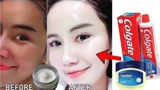 Applied Toothpaste And Vaseline On My Face At Night For 5 Minutes Watch What Happened After [upl. by Yboc]