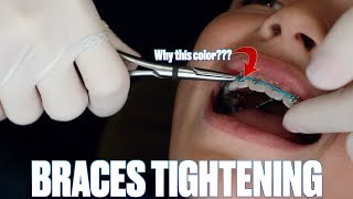 GETTING BRACES TIGHTENED FOR THE FIRST TIME  CHANGING BRACES RUBBER BANDS COLOR  HIDDEN MEANING [upl. by Enad]