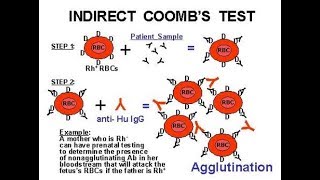 Indirect Coomb Test ICT [upl. by Kcirb882]