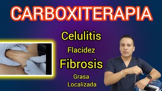 Carboxiterapia  Celulitis flacidez fibrosis Grasa Localizada  Aplicación [upl. by Aicargatla448]