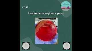 TBT Streptococcus anginosus group [upl. by Yemirej185]