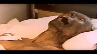 Acute radiation syndrome the Ministry of defense of the USSR 1988 HD [upl. by Oalsinatse561]