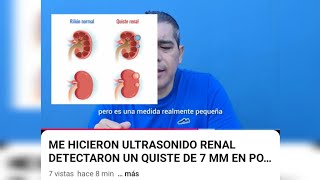 ME HICIERON ULTRASONIDO RENAL DETECTARON UN QUISTE DE 7 MM EN POLO SUPERIOR SIN HIDRONEFROSIS [upl. by Debi]