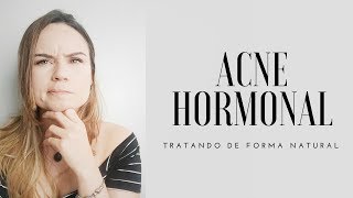 ACNE HORMONAL  COMO TRATAR DE FORMA NATURAL [upl. by Eciralc]