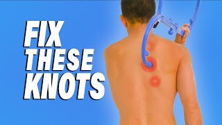 How to Release Knots Between Shoulder Blades NO MASSAGE SOLUTIONS [upl. by Ggerc260]